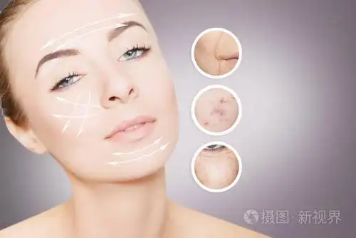 修复皮肤: 女人带走她旧的皮肤