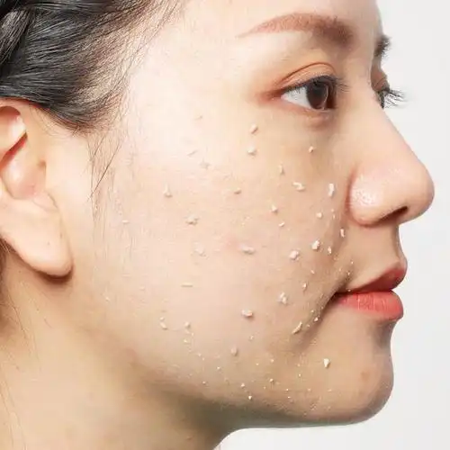 在我们日常的护肤中,脸部角质层是一个至关重要的组成部分.