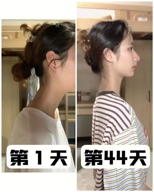 脖子前倾(如图2)26615如何选择合适健康的枕头(如图3)7215