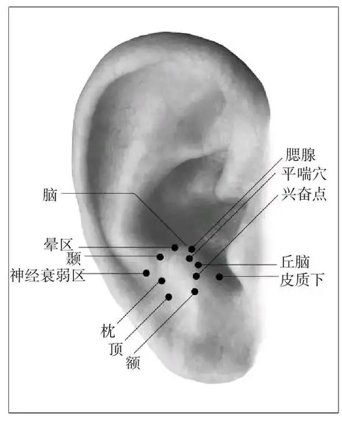 百病全息按摩疗法图解