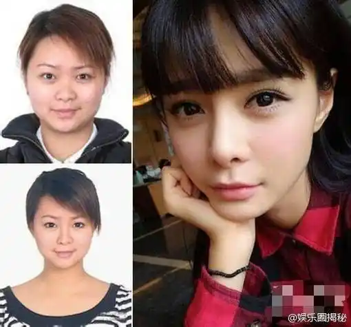 明星整容前后,meg ryan整