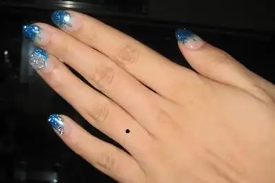 无名指长痣的人容易找一个旺自己的配偶