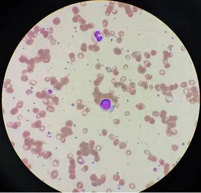 无法纠正的红细胞凝集,结果到底该如何发?