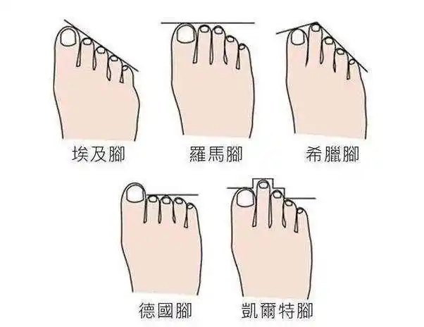 这类脚型特别普遍,简单描述为大拇指最长,其他脚趾的长度依次递减.