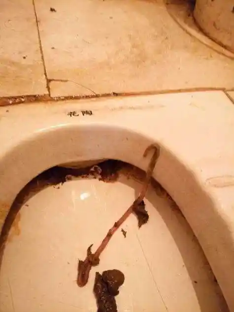 梦到好多屎恶心的想吐