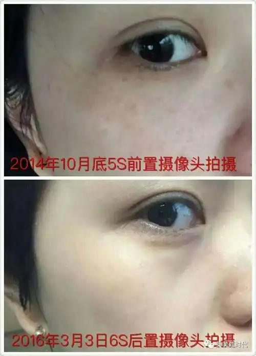 莱芙蔻"抗衰老生命密码护肤品祛斑祛痘去褶皱"产品使用前后惊人对比图