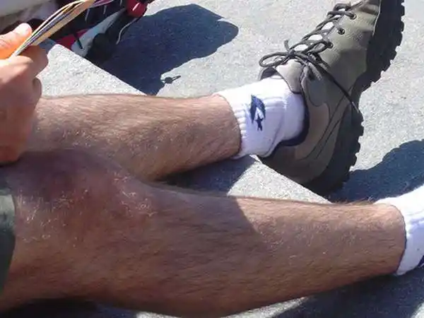 「体毛愈刮愈粗,愈刮愈黑?