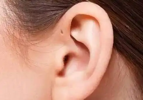 心理测试:凭直觉,哪一个耳朵是最有福气的?测你能否赢得美人归