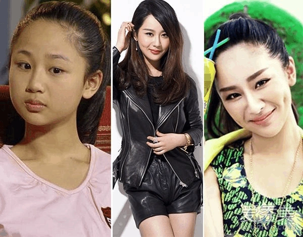 整容励志篇:5位女明星整容后美哭了!