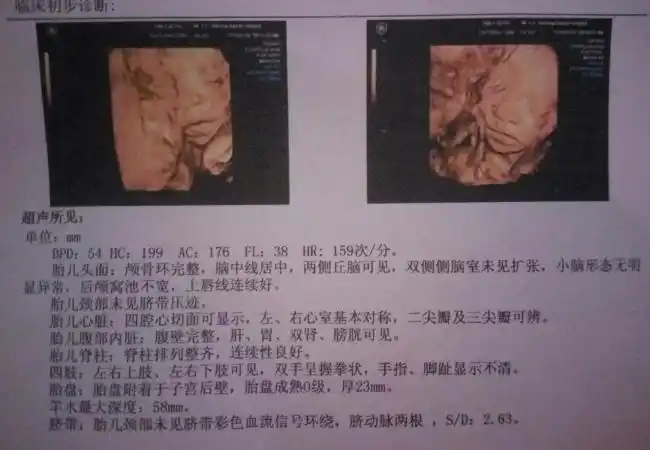 6个月四维女孩却生了男孩 孕妈们别信了