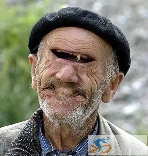 最恐怖恶心的图片