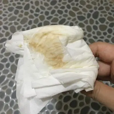 今天怀孕刚好12周又流了褐色的血了,不过量比之前的多了,10周的时候有