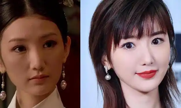 网友质疑毛晓彤整容!在《庆余年》里,假体都要飞出来了!太吓人