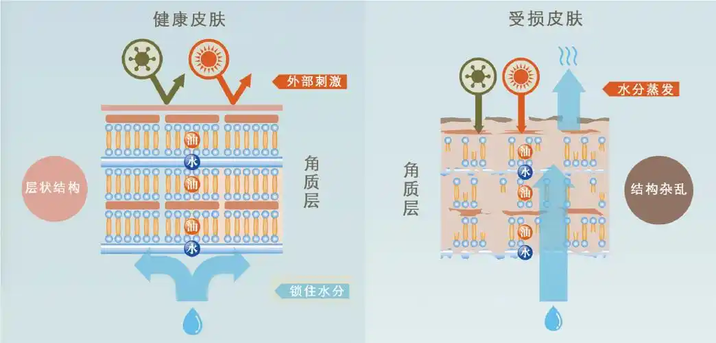 去角质的好处(去死皮去角质对皮肤好吗)_大全-幸福起航