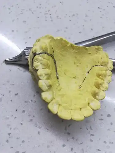 有口腔专业的吗,想请教一个问题