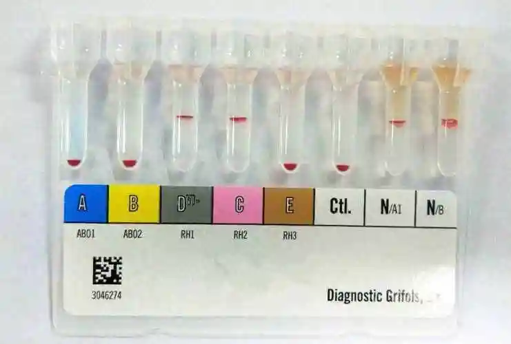 血型报告单上阴性阳性究竟是不是代表身体有什么疾病呢?