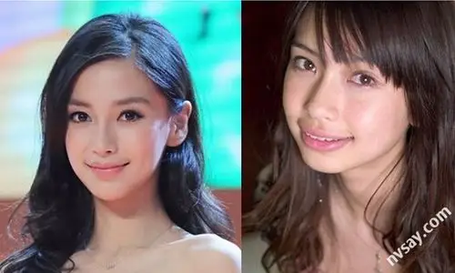 杨颖整容前后照片