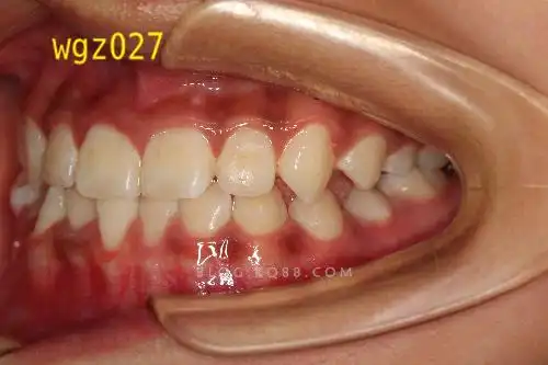 她的尖牙关系如何变化过来的原创