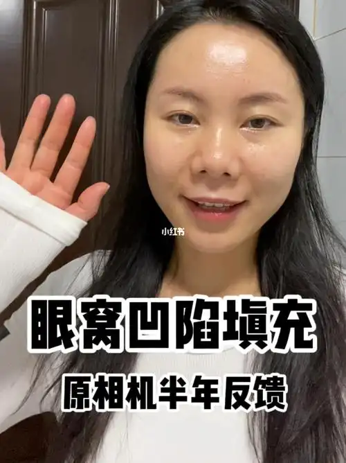 眼窝凹陷填充半年反馈