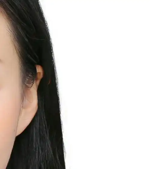 有没有姐妹耳朵形状奇怪?以及有没有办法矫正