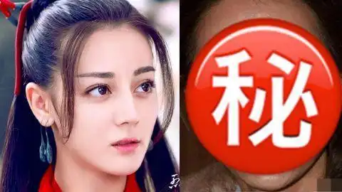 热巴零修图素颜照疯传! 黄脸,深坑吓坏大家,真的是她?