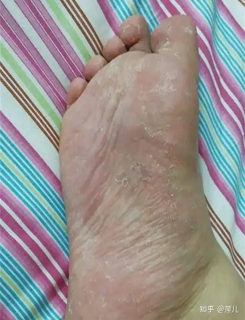 女生脚臭是种什么样的体验