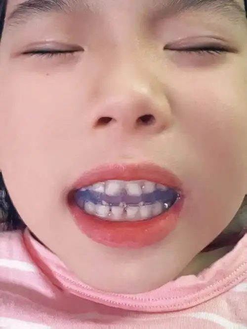 早期干预,希望是2024年做的最正确的决定!