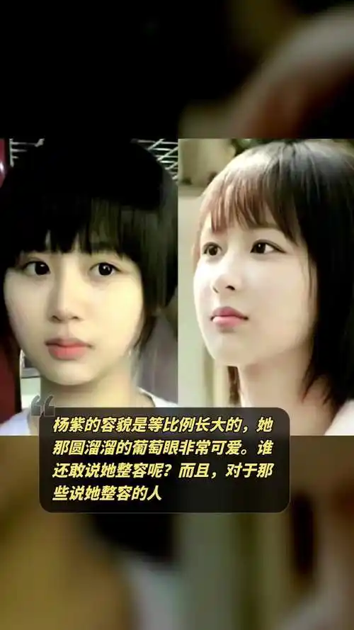 谁还敢说她整容呢?