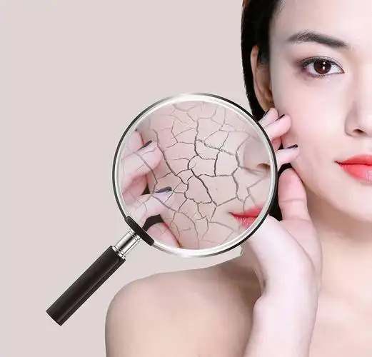 公主家应该如何护理肌肤干燥?