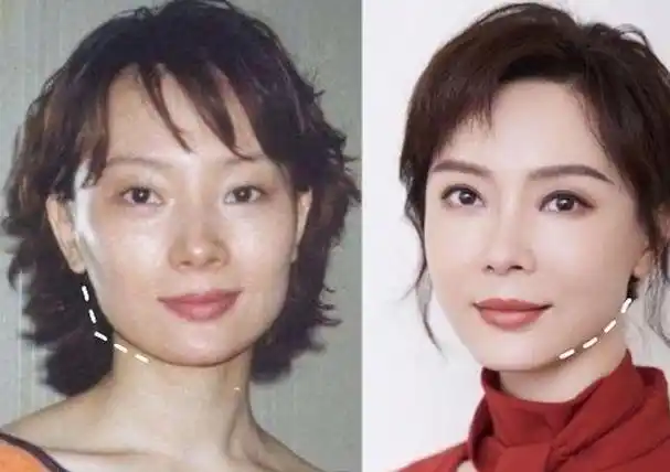 回顾事实证明46岁整容失败的陈数或许不再被众人所宽容