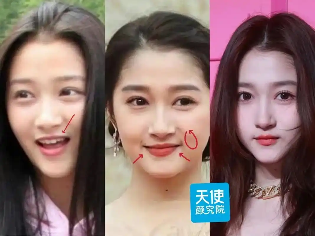 关晓彤是不是do脸了?凹脸变得幼态又平整!