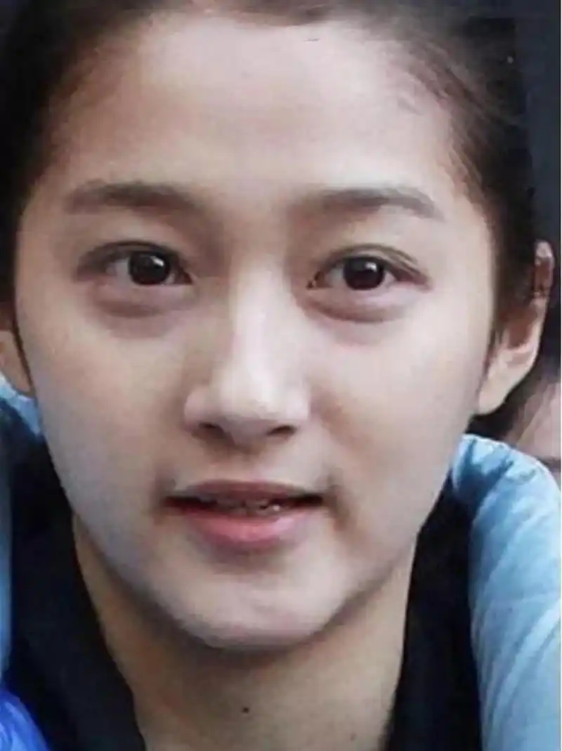 关晓彤年纪轻轻眼袋那么重,比鹿晗都显老 关晓彤的眼袋到底是怎么了?