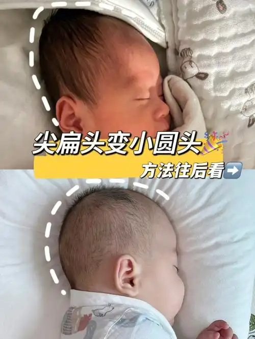 尖扁头成功逆袭小圆头干货必看60