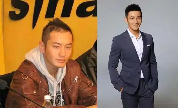 大部分植发的明星都是男星,其中最容易被大家看出来的应该就是黄晓明