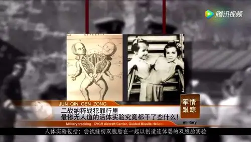 二战纳粹战犯罪行里,最惨无人道的活体实验究竟都干了些什么!