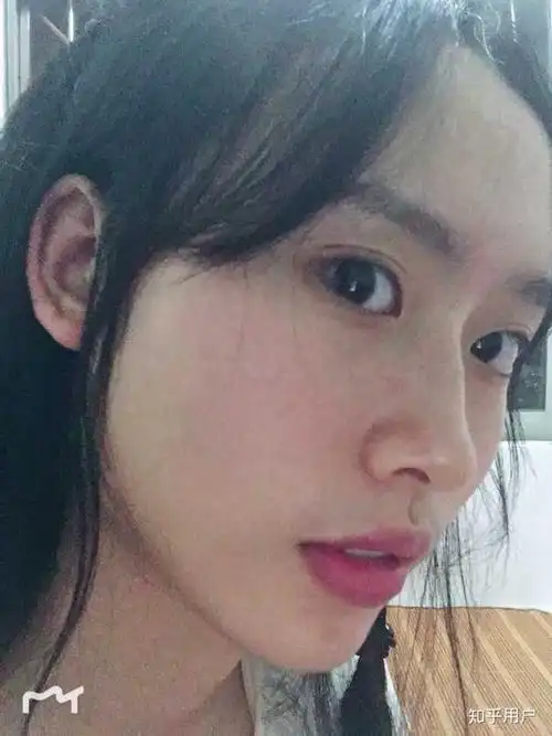 这张侧面驼峰鼻明显