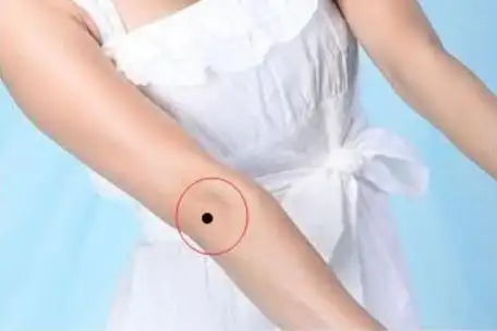 有横财的痣有哪些