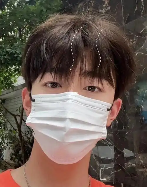 厦门男士烫发   凌乱微分碎盖 烫完被女神倒追发型 男士蝴蝶烫壮鲻