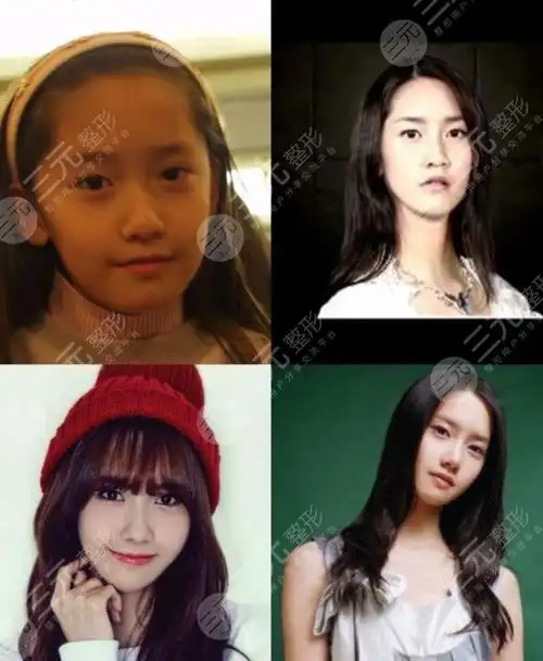 30的林允儿颜值依旧在线整容动过骨却不脸崩林允儿动了哪里