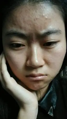 其实轻松几招就可以帮你搞定尴尬|暗黄|皮肤|脸色_新浪网