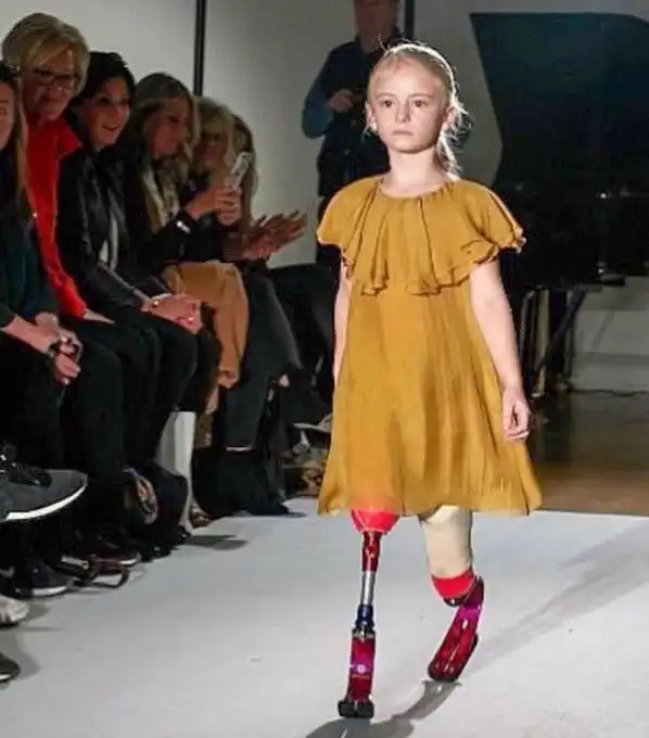 与众不同是我最大的特点英国9岁双义肢女童t台走秀