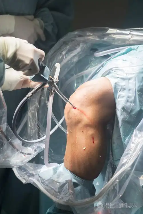 膝关节外科医院手术照片-正版商用图片0xjc57-摄图新视界