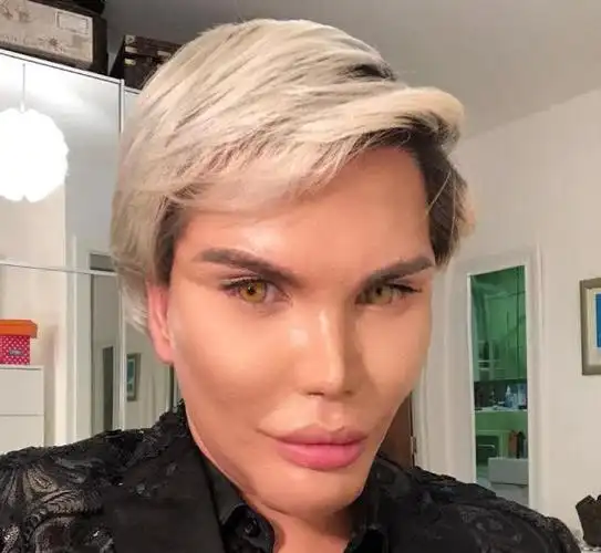 全球整容最"疯狂"的男子,全身除了脑子,全部地方都整了容