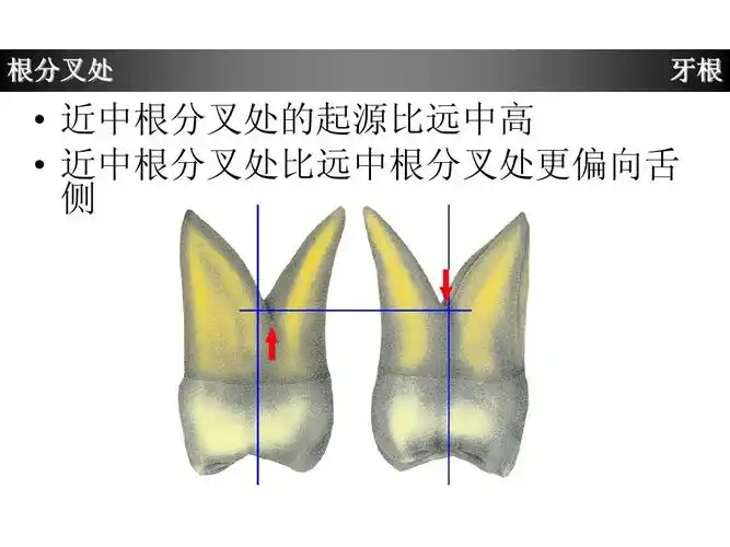 上颌第一磨牙牙体形态简述ppt