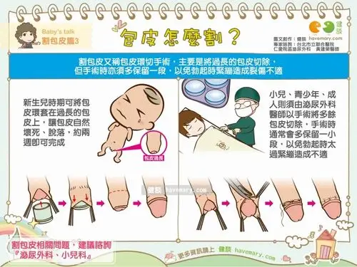 ▼大人小孩的包皮怎麼割?一张图看懂.(图/健谈授权提供)