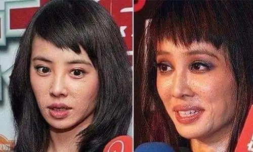 这些明星最想删掉的"黑历史"照片,真的很丑!