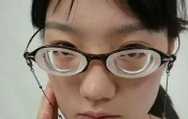 高度近视患者适合做近视眼手术吗?