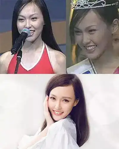 21位明星出道前的旧照片,到底谁的颜值,才是开挂的?|明星|肖战|李现_