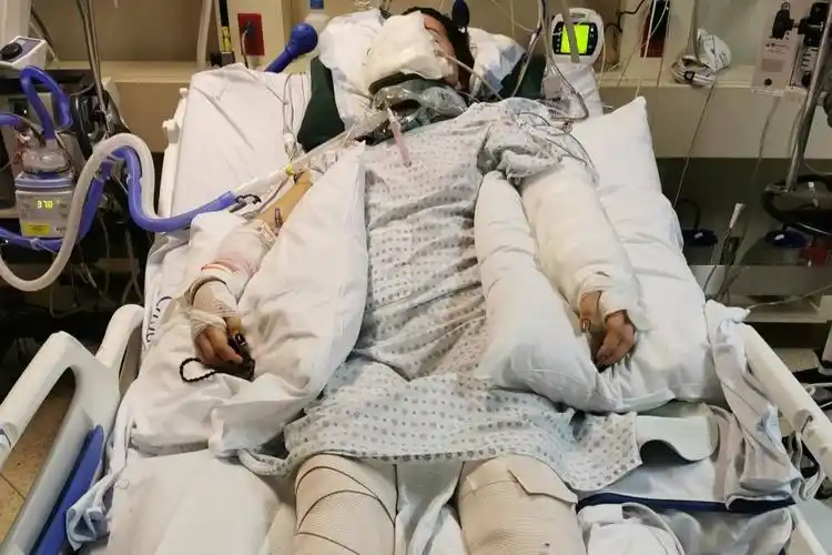 woman, 24, faces life-altering injuries after be