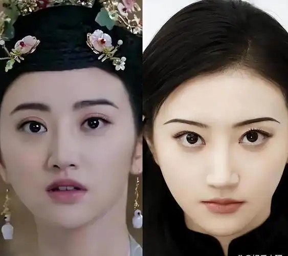 双眼皮别乱瞎割从景甜到戚薇,这几位演员的"后遗症"出来了